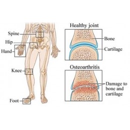 Belle&Bio Glucozamina Condroitina MSM 120 Capsule – Mobilitate & Cartilaj Beneficii Glucosamina-Condroitina: contine Glucozamina