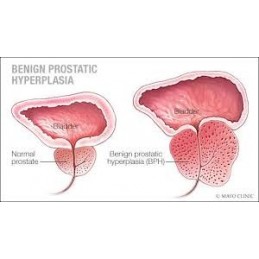 Belle&Bio Prostate BIO 120 Capsule – Suport Prostata 40+ Prostate Bio beneficii: ameliorator naturist prostata, sustine functia 