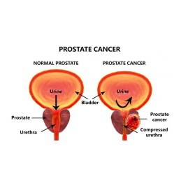 Prostate Bio 120 Capsule, Tratament pentru prostata, Belle&Bio Prostate Bio beneficii: ameliorator naturist prostata, sustine fu