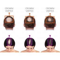 FOLIGAIN Trioxidil 2% 236 ml Balsam regenerare par femei – Fortifica si Densifica Balsam impotriva caderii părului cu stimulente