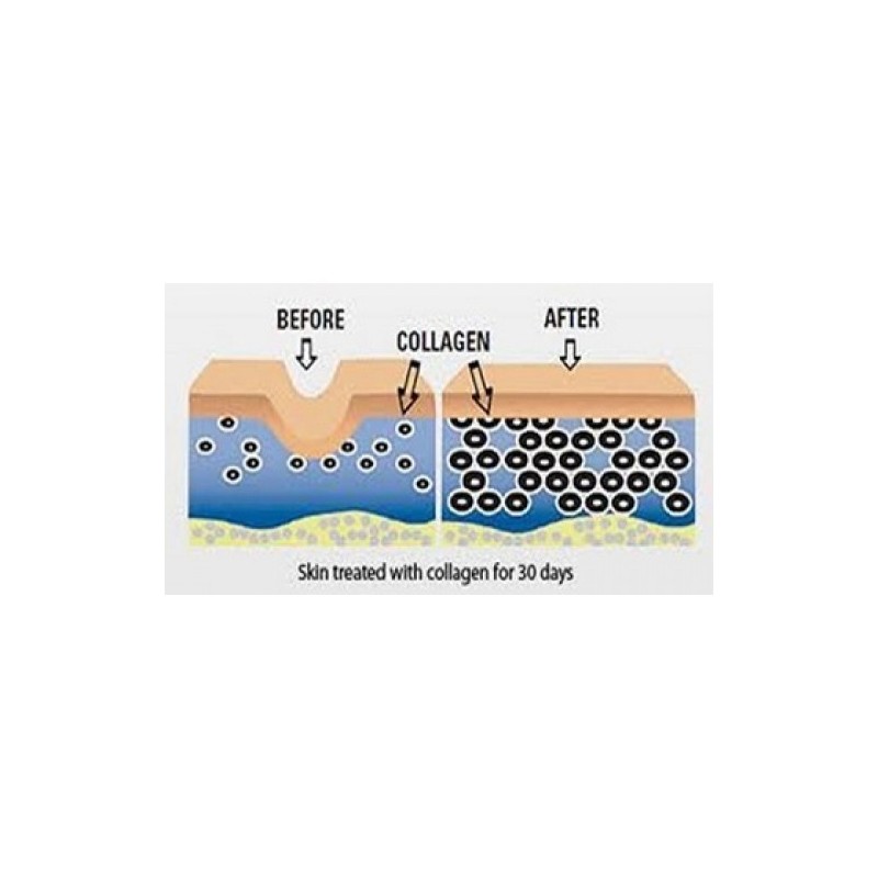 Colagen Hidrolizat Tip 1 & 3 120 Capsule, Biovea - 3 | YEO