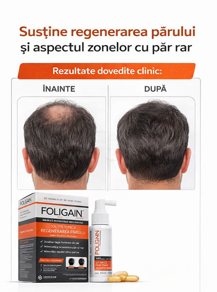 Rezultate folosire Foligain Minoxidil Trioxidil la barbati